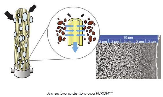 Mbr: Nova Tecnologia Para Tratamento De Efluentes